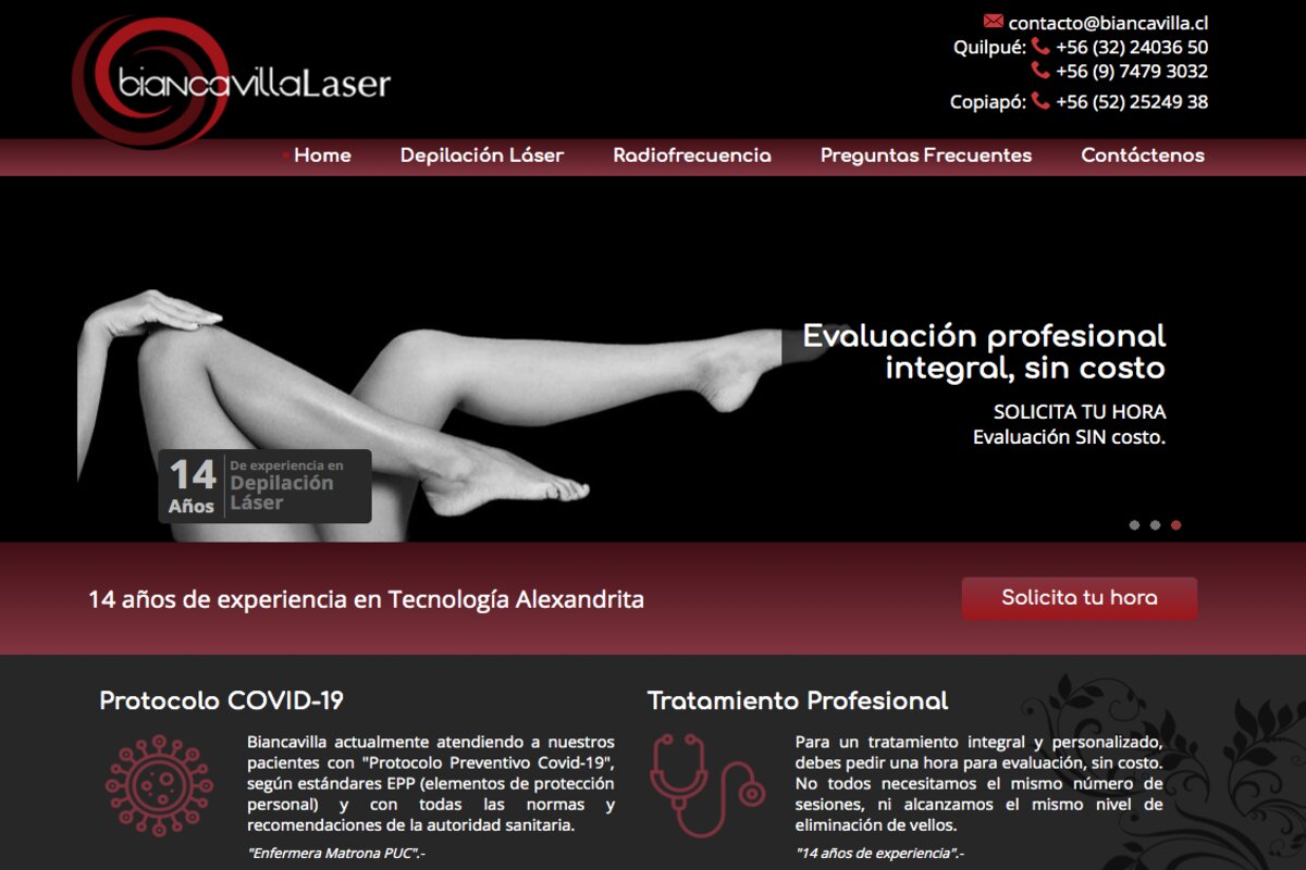 Depilación permanente en Viña del Mar